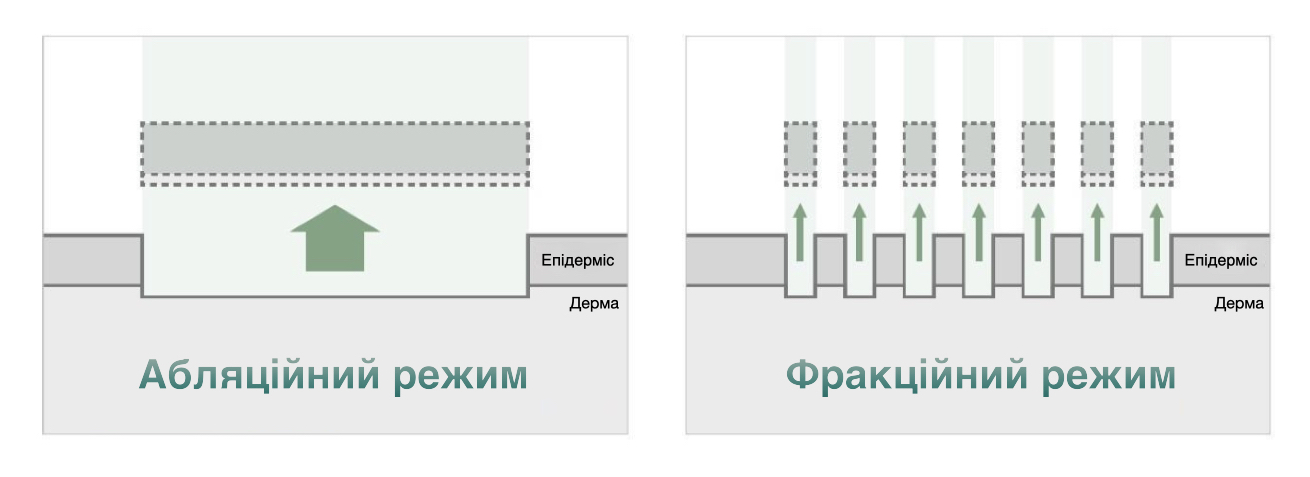 Asclepion MultiPulse PRO ➜ Професійний лазер CO2 в Україні | Alfaspa зображення 50